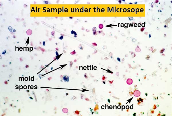 Mold 3 air sample under the microsope containing mold spores